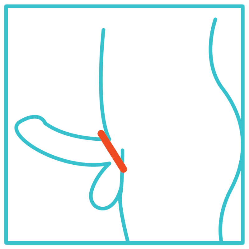 Single loop cock ring including balls.png